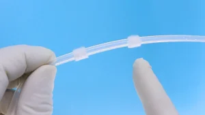 Cuff: Qual é a sua função no cateter de diálise peritoneal?