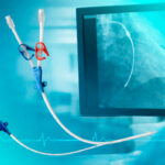 O que significa “Cateter Radiopaco”? Entenda sua importância clínica