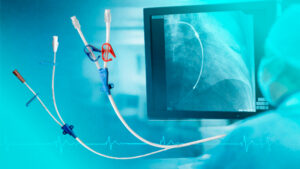 O que significa “Cateter Radiopaco”? Entenda sua importância clínica