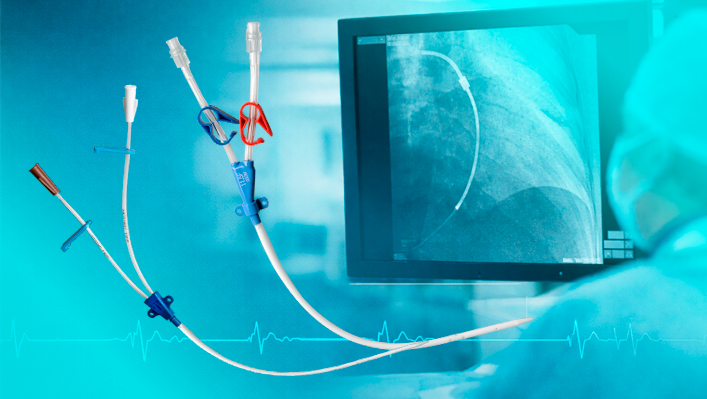 O que significa “Cateter Radiopaco”? Entenda sua importância clínica