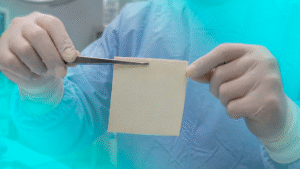 Biopatch Biomedical: tecnologia nacional em enxertos orgânicos para cirurgias seguras