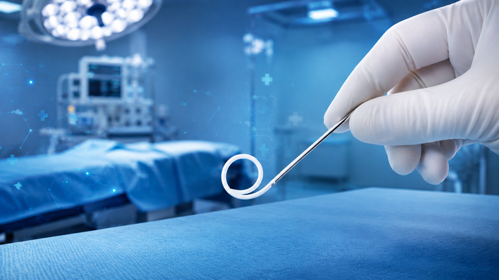 Quando um Cateter Ureteral Duplo J é Utilizado? Indicações e Funcionamento